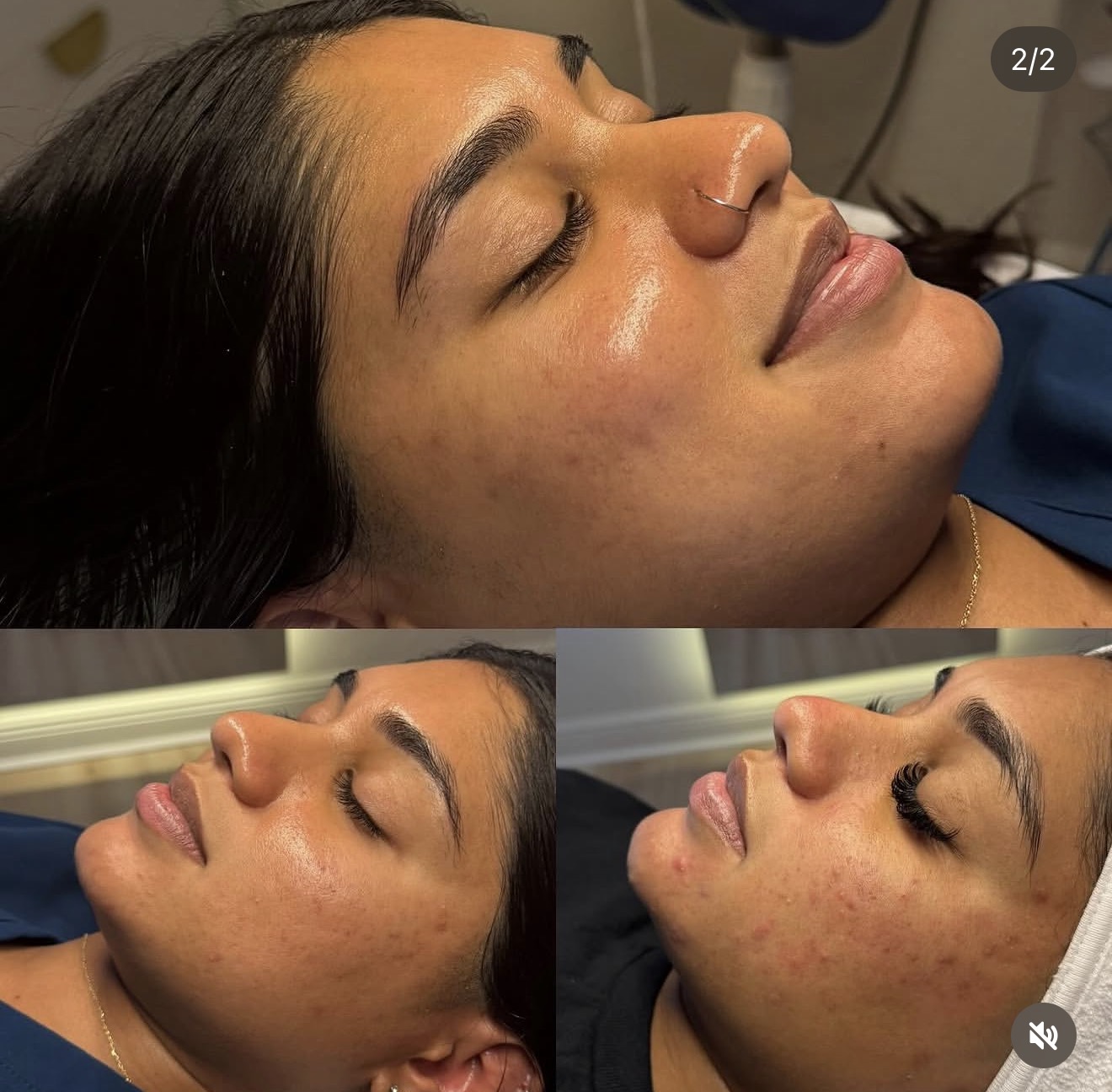 Three close-up side profiles of a woman with dark hair and clear skin, eyes closed, showing her face from different angles.